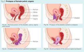 female pelvic floor 1 anatomy and pathophysiology nursing