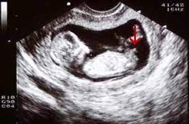What happens at a dating scan? The Simple Trick To Tell The Sex Of Your Baby At Just 12 Weeks But Does It Really Work