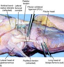 A lateral collateral ligament injury of the knee is also referred to as the fibular collateral ligament injury and comprises a spectrum of injuries ranging from 'sprain' over 'tear' to 'rupture'. Lateral Posterior And Cruciate Knee Anatomy Musculoskeletal Key