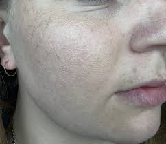 Night skincare routine with multiple products