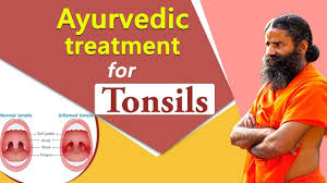 Treatment and cure for pustular tonsillitis. Ayurvedic Treatment For Tonsil Swami Ramdev Youtube