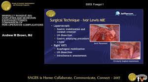 How long does it take to heal a mckeown esophagectomy? Minimally Invasive Mi Ivor Lewis Mckeown Esophagectomies Comparison Of Peri Operative Complications From The Sages Video Library
