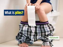 A group of several things of the same ty.: What Is Piles Check Out Its Symptoms Causes And Treatment