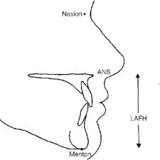 There is no wrong order in doing this, it is just how. Lower Face Vertical Proportion Was Calculated Using Lower Anterior Face Download Scientific Diagram