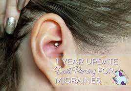 Migraine Piercing 1 Year Results After Daith Piercing For Headaches