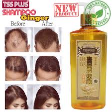 A shampoo for fast hair growth. Amazon Com Tssplus New Ginger Genuine Professional Hair Ginger Shampoo Hair Regrowth Dense Fast Thicker Hair Growth Conditioner Anti Hair Loss Product Beauty
