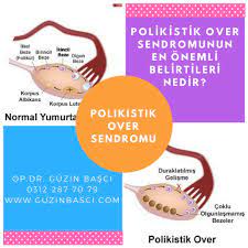 ref pano panosundaki pin