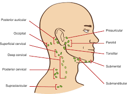 Lymphknoten Am Hals Geschwollen Was Tun
