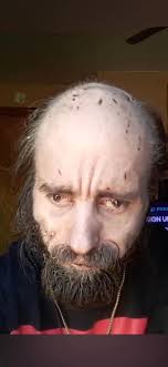 Blackbeard have 3 different loosing teeth, means 3 Blackbeard OR 3  personality?🤔 He loose them not because he get older, look The timeline  not quit far i think (Killing thatch > Meet