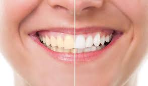American aesthetic medical center, run by director dr. American Aesthetic Medical Center Dubai Review Rate Your Customer Experience