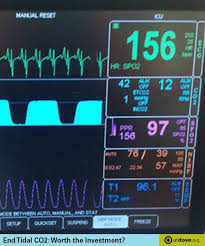 This Article Discusses Why We Should Be Monitoring End Tidal Co2 And How To Troubleshoot Abnormal Va Vet Medicine Veterinary Tech Veterinary Technician Student