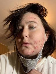 2020 Disrupted: A Re-Assembled Life — Wayne Brezinka