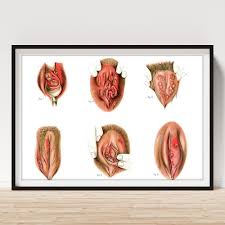 Image result for chancroid