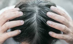 One study participant went on vacation and five hairs on their head reverted back to dark during the time away. Stress Does Turn Hair Gray But It Might Be Reversible Scientists Say Daily Mail Online