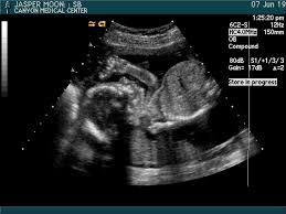 We at baby ultrasound co use new cutting edge ultrasound technology to bring images of your baby to life. Birth Bodywork Blog Growing Season