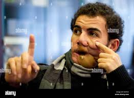 Successful reconstruction hi-res stock photography and images