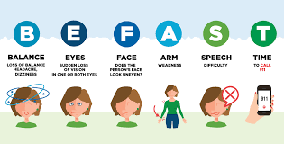 Weakness, numbness, double vision or vision loss, confusion, vertigo, difficulty speaking or understanding speech. The Warning Signs Of A Stroke Mercy Health Blog
