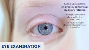 Examination Of The Eyes And Vision Osce Guide Youtube
