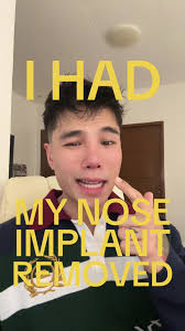 Understanding My Nose: The Full Story of My Nose Sinus Removal