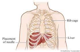 Identify the costal margin (lower border of the rib cage) on your right side. Liver Cancer Diagnosis Roswell Park Comprehensive Cancer Center