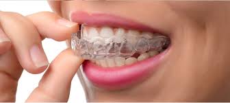 We look forward to being your orthodontist in centennial and highlands ranch, co! Braces Comfort Dental