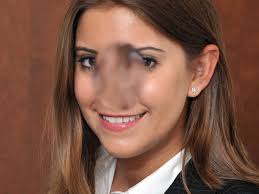 Two weeks Vitrectomy Post-op Visit