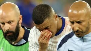 Šok za Francuze! Mbappe slomio nos, upitan je za nastavak Eura