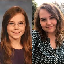 Crohn's disease — Articles — Crohn's & Colitis Young Adults Network