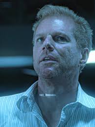 Doctor Jenner Explains Walker Transformation Process