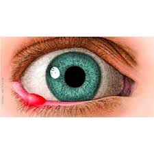 Leacuri Din Popor Pentru Urcior Orjelet Eye Stye Remedies Treating A Stye Stye Treatment