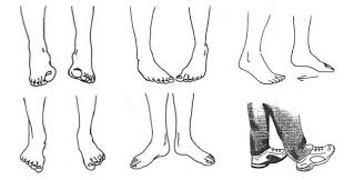 Foot Drills Eliminate Plantar Fasciitis Shin Splints Achilles Tendinitis Knee Ankle Problems Achilles Tendonitis Plantar Fasciitis Shin Splints
