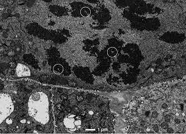 What is transmission electron microscopy ? Scanning Electron Microscopy Of Chromosomes Chapter 9 Scanning Electron Microscopy For The Life Sciences