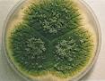 Resultado de imagen de Aspergillus