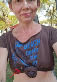 Getting stung by a yellow jacket doing yard work