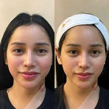 The beauty secret everyone’s whispering about. Secure your slot today. 💕,  📍 Location: Alagang Inchang Las Piñas