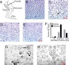 I went to see my family doctor for my anxiety problems for the first time today, and he gave me stresam, an anxiolytic drug, saying that it was not too strong and that i wouldn't be dependent of it. Etifoxine Improves Peripheral Nerve Regeneration And Functional Recovery Pnas