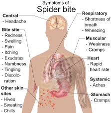 How long do spider bites last? How To Identify Spider Bites Triangle Pest Control
