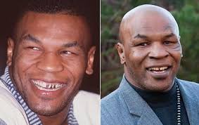 Gold) 2.7 out of 5 stars 655 $7.98 $ 7. Wife Says Mike Tyson Lost A Tooth After Being Headbutted By His Tiger