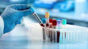 Estou muito satisfeita e recomendo à todos!!!!! A Diversidade Dos Exames Para Detectar Novo Coronavirus No Brasil Medicina S A