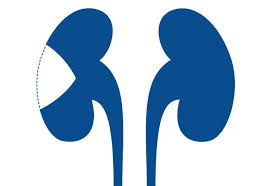 You can get more information about pancreatic some of the signs of kidney cancer are blood in your urine, which may appear pink, red or cola colored, back pain below the ribs that doesn't go away. Kidney Cancer Care At Mayo Clinic Mayo Clinic