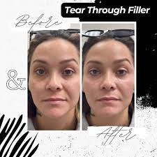 Bespoke Medical Aesthetics & Wellness