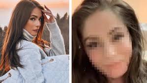 Krásná, úspěšná česká youtuberka týnuš třešničková. Tynus Tresnickova Ukazala Poprve Tvar Bez Make Upu Jak Fanousci Reagovali Na Jeji Zjizvenou Tvar Evropa 2