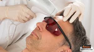 كيف يمكن إزالة الشعر بالليزر للرجال بكفاءة وسهولة تسعة