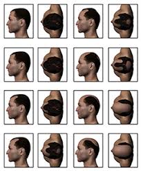 Androgenetic alopecia is another term for male or female pattern baldness. Difference Between Male And Female Hair Loss Hair Loss Haircaretotal