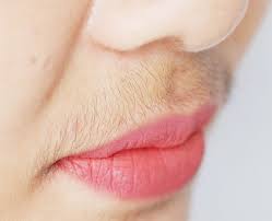 But to permanently get rid of it you can use natural home remedies, which are less painful and. Five Easy Remedies To Remove Upper Lip Hair