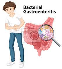 Viral gastroenteritis spreads from person to person through contact with an infected person's stool or vomit. Mann Und Diagramm Die Bakterielle Gastroenteritis Fototapete Fototapeten Medicals Ungesund Keim Myloview De