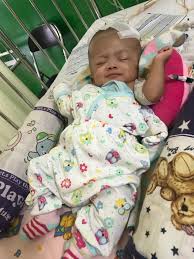 Bayi Arisha Lahir Prematur Menderita Hidrosefalus Butuh Bantuanmu Kumparan Com