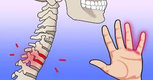 10 Causas De Dormencia Nas Maos Que Indicam Que E Preciso Procurar Um Medico Urgente Incrivel