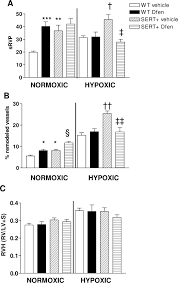 Image result for Dexfenfluramine