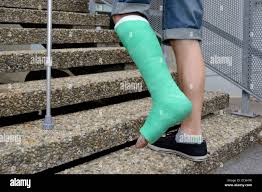 Image result for Short Leg Cast